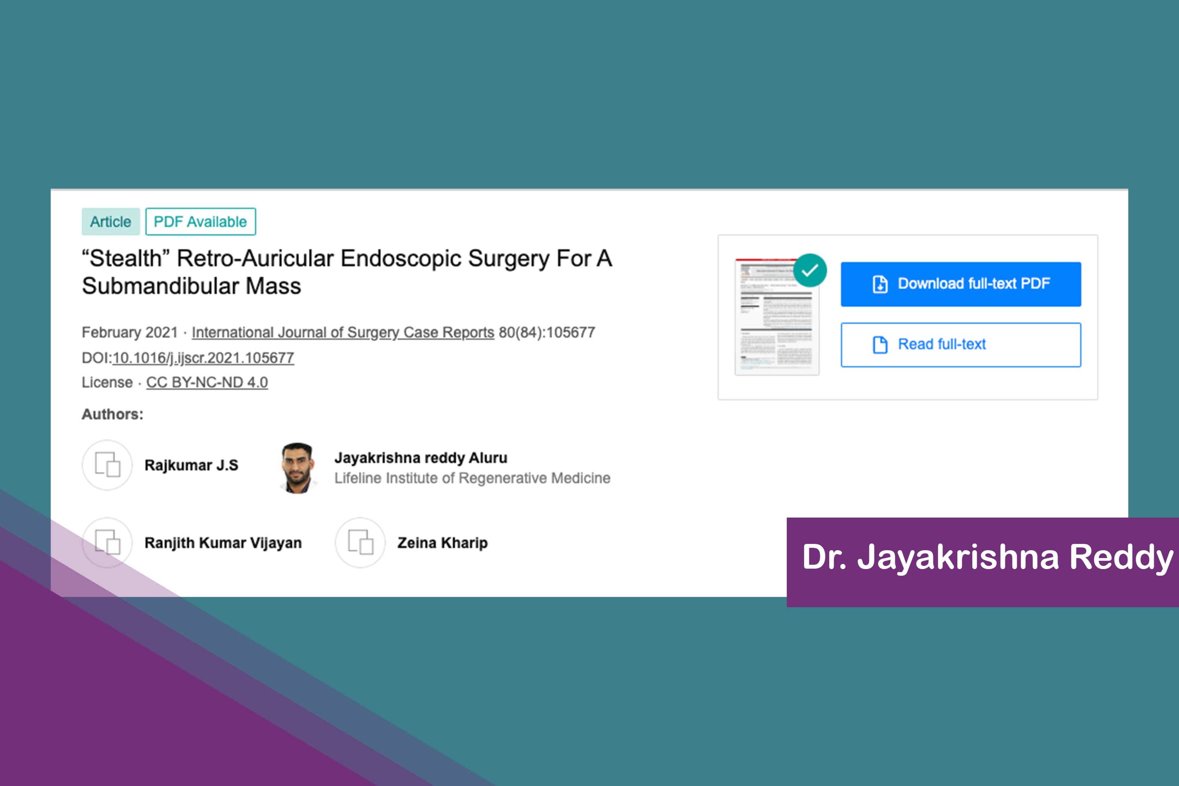“Stealth” Retro-Auricular Endoscopic Surgery For A Submandibular Mass