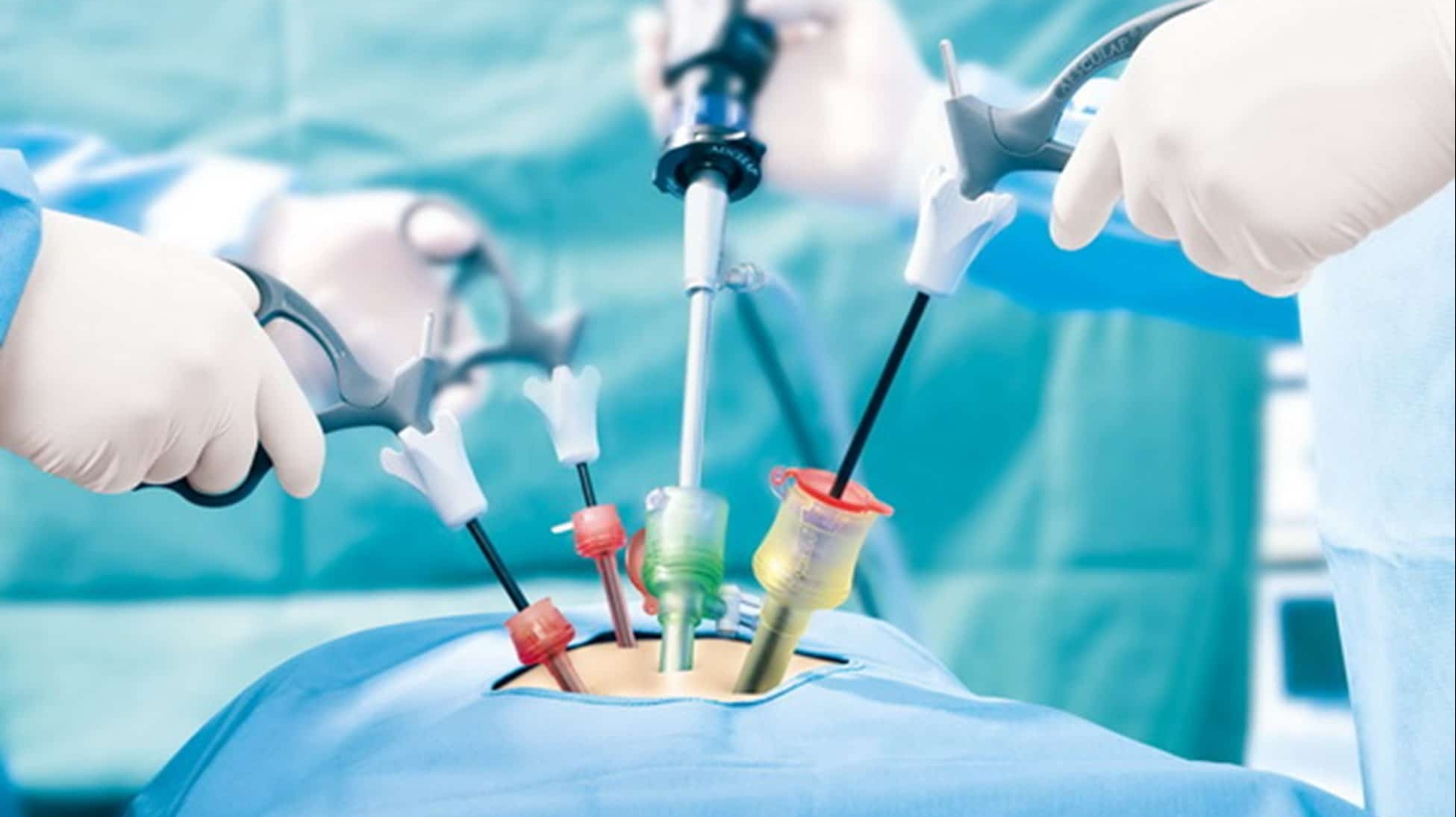 ADVANCED LAPAROSCOPIC SURGEON & PROCTOLOGIST ADVANCED LAPAROSCOPIC SURGEON & PROCTOLOGIST