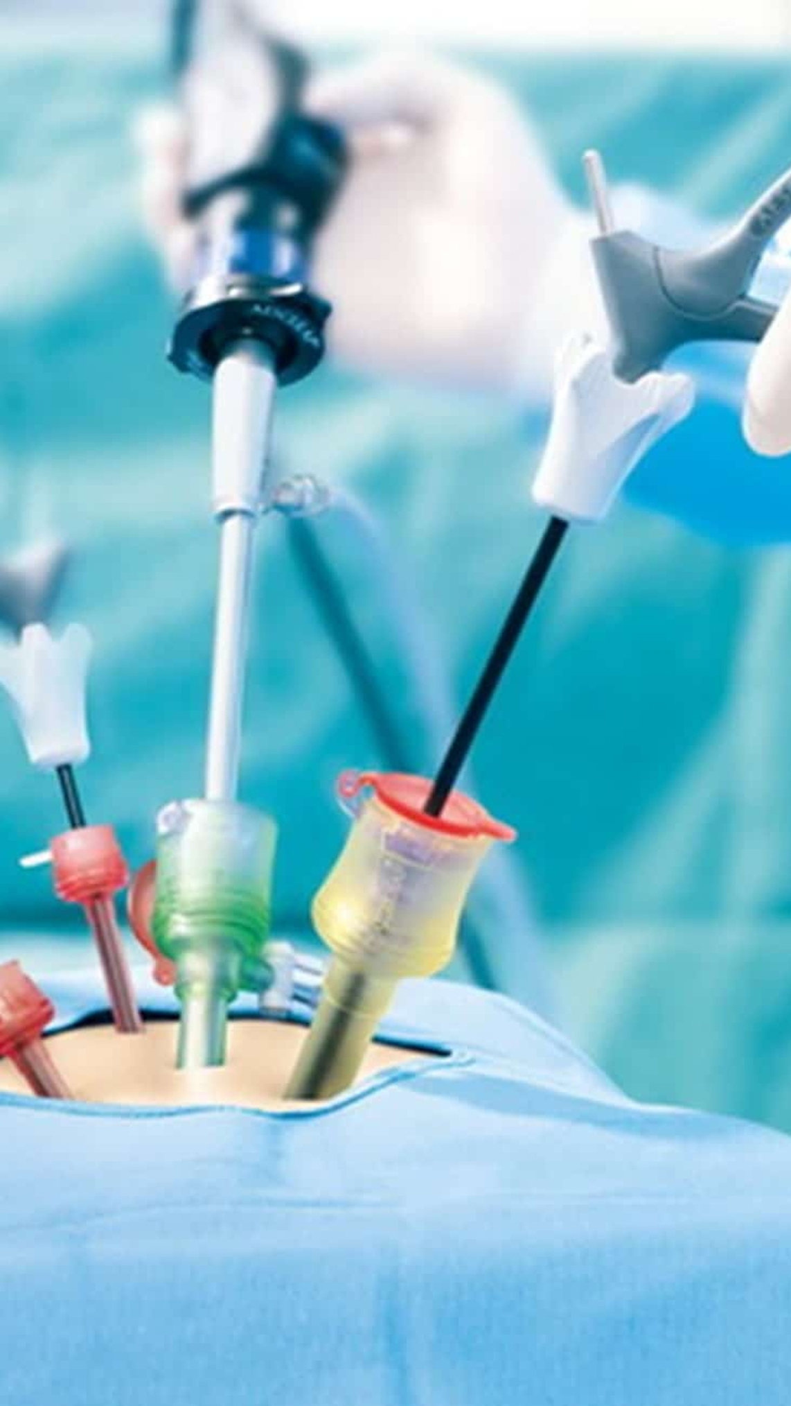ADVANCED LAPAROSCOPIC SURGEON & PROCTOLOGIST ADVANCED LAPAROSCOPIC SURGEON & PROCTOLOGIST